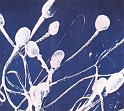 Spermiji gledani elektronskim mikroskopom